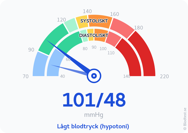 Blodtryck 101 över 48 – lågt blodtryck (hypotoni) – visuell mätare