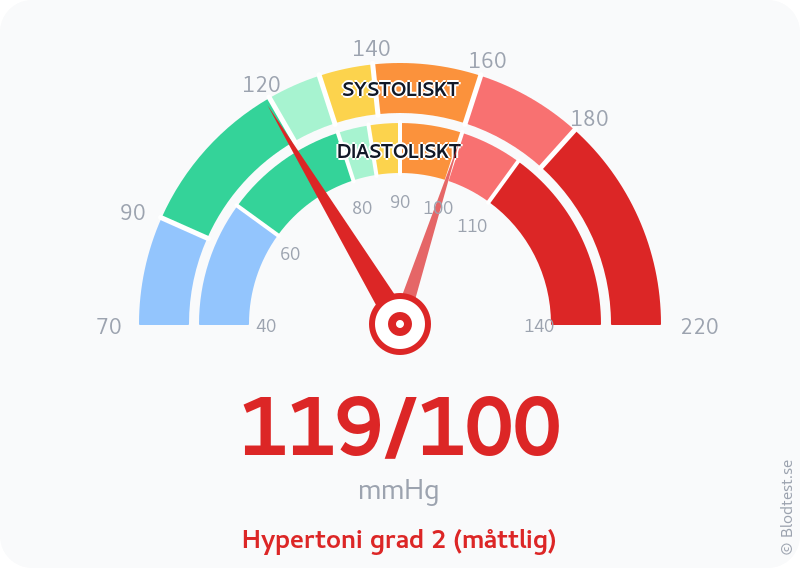 Blodtryck 119 över 100 – hypertoni grad 2 (måttlig) – visuell mätare