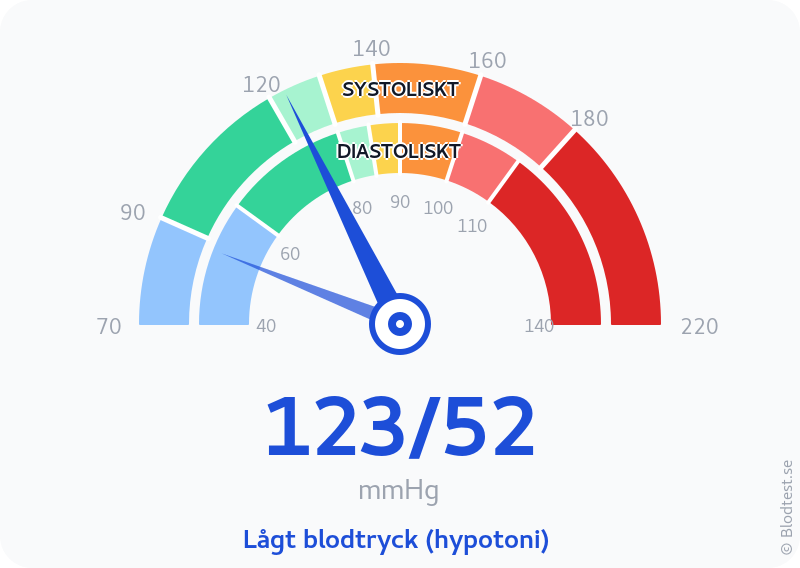 Blodtryck 123 över 52 – lågt blodtryck (hypotoni) – visuell mätare
