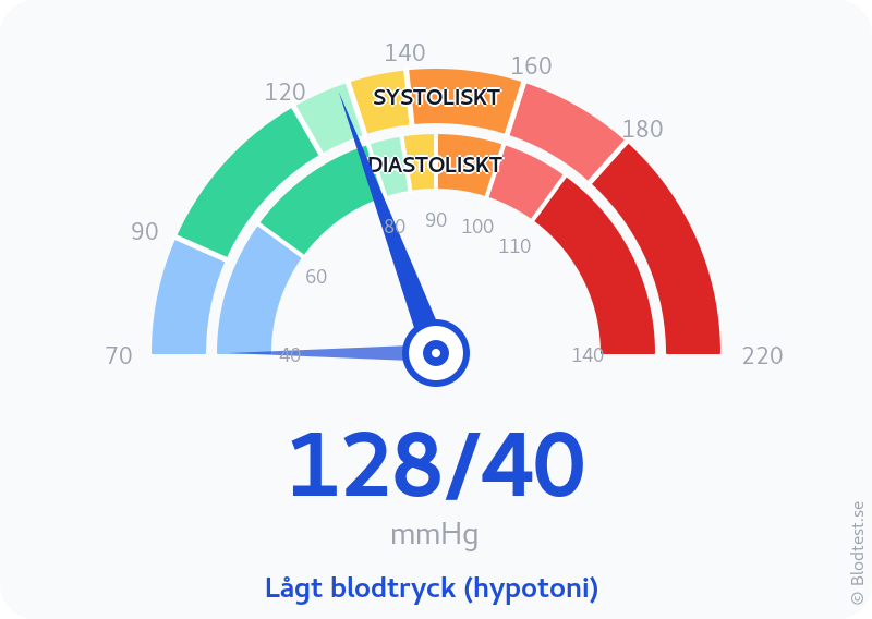 Blodtryck 128 över 40 – lågt blodtryck (hypotoni) – visuell mätare