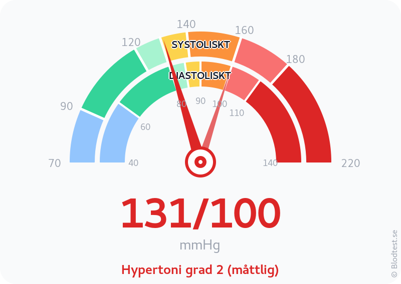 Blodtryck 131 över 100 – hypertoni grad 2 (måttlig) – visuell mätare