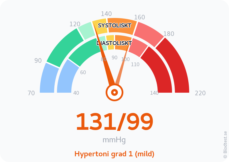 Blodtryck 131 över 99 – hypertoni grad 1 (mild) – visuell mätare