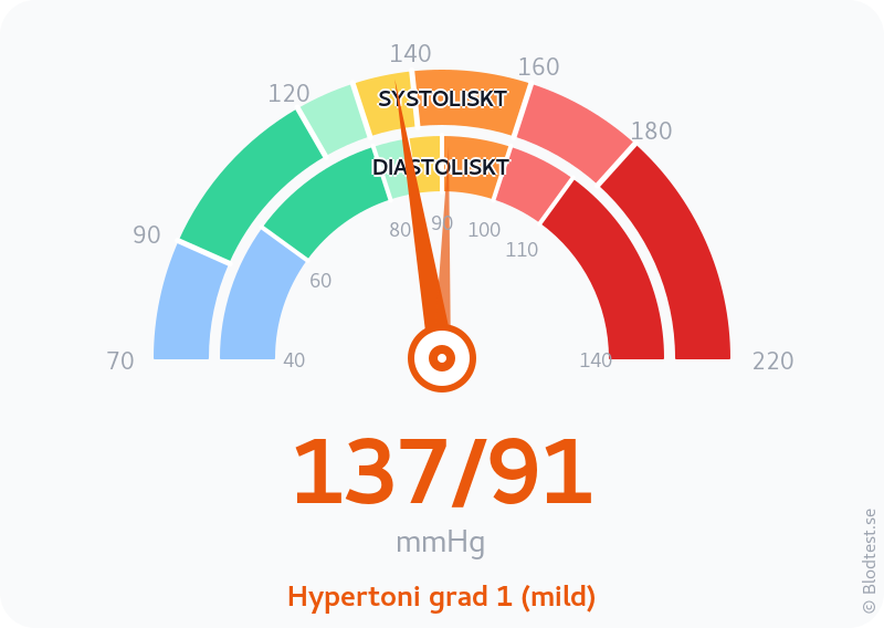 Blodtryck 137 över 91 – hypertoni grad 1 (mild) – visuell mätare
