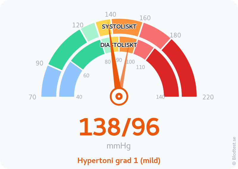 Blodtryck 138 över 96 – hypertoni grad 1 (mild) – visuell mätare
