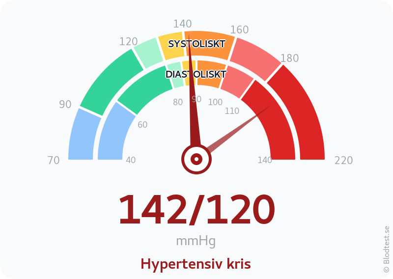 Blodtryck 142 över 120 – hypertensiv kris – visuell mätare