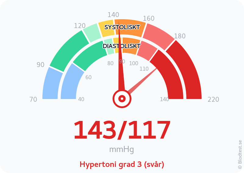 Blodtryck 143 över 117 – hypertoni grad 3 (svår) – visuell mätare
