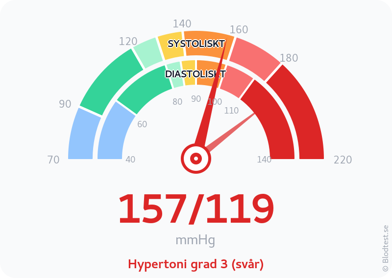 Blodtryck 157 över 119 – hypertoni grad 3 (svår) – visuell mätare