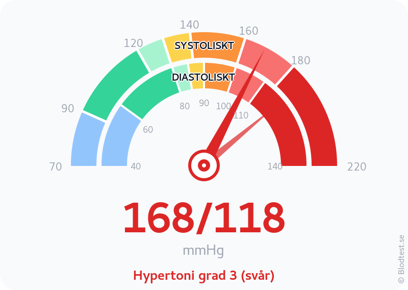 Blodtryck 168 över 118 – hypertoni grad 3 (svår) – visuell mätare