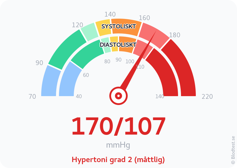 Blodtryck 170 över 107 – hypertoni grad 2 (måttlig) – visuell mätare