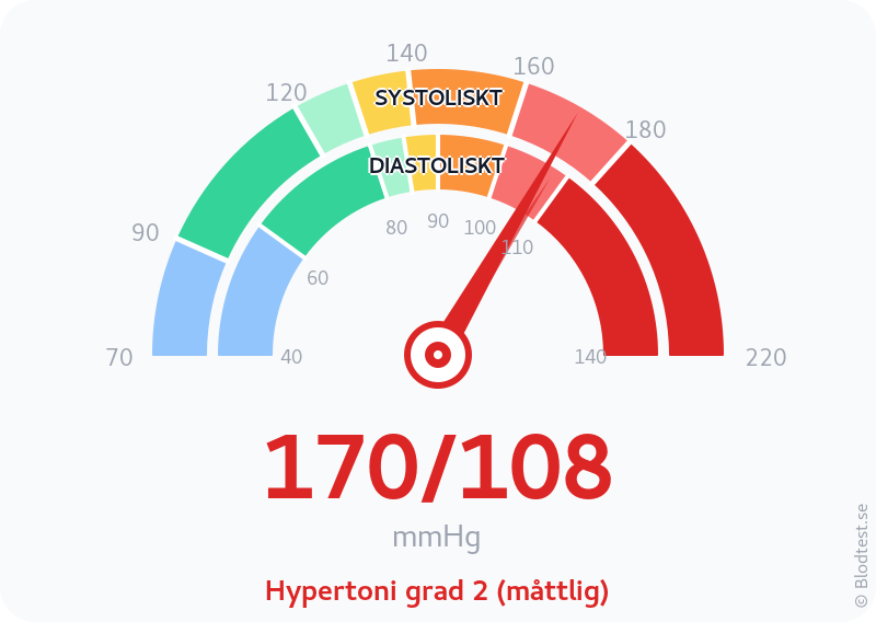 Blodtryck 170 över 108 – hypertoni grad 2 (måttlig) – visuell mätare