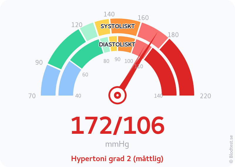 Blodtryck 172 över 106 – hypertoni grad 2 (måttlig) – visuell mätare