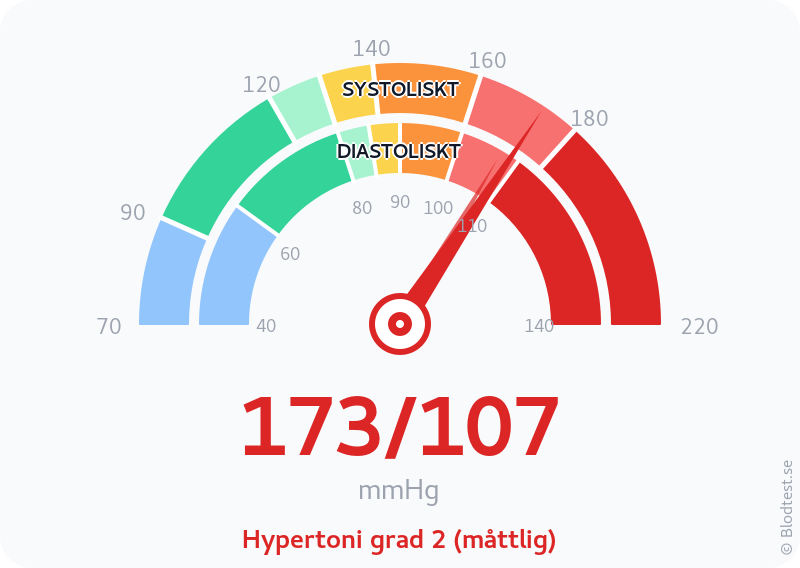 Blodtryck 173 över 107 – hypertoni grad 2 (måttlig) – visuell mätare
