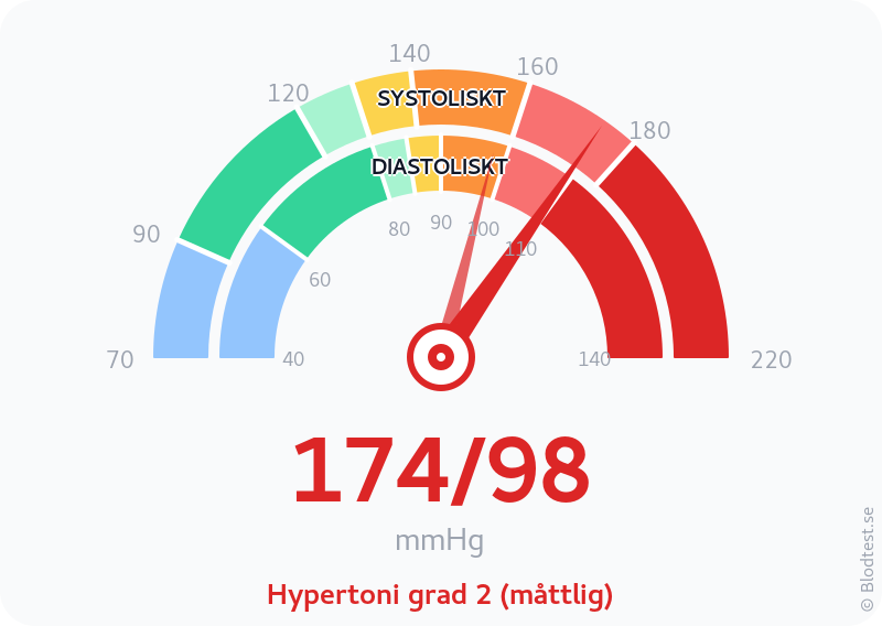 Blodtryck 174 över 98 – hypertoni grad 2 (måttlig) – visuell mätare