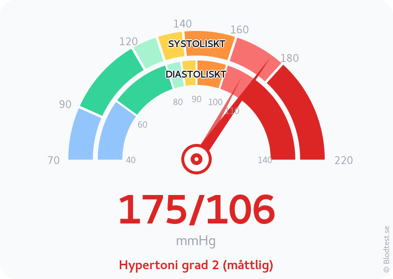 Blodtryck 175 över 106 – hypertoni grad 2 (måttlig) – visuell mätare