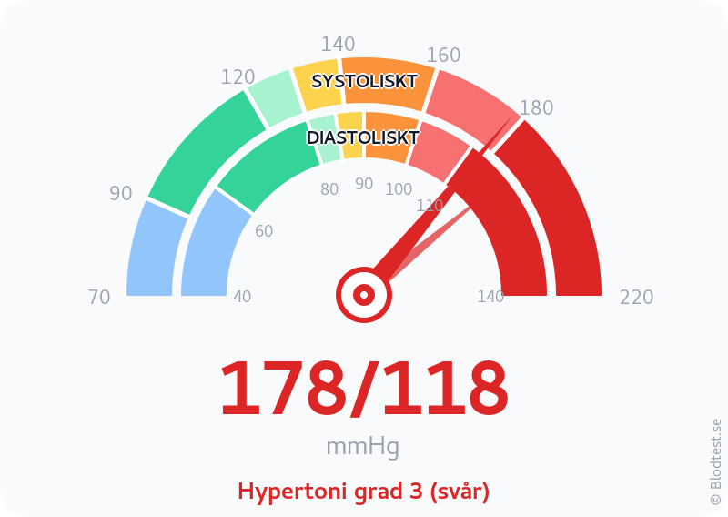 Blodtryck 178 över 118 – hypertoni grad 3 (svår) – visuell mätare