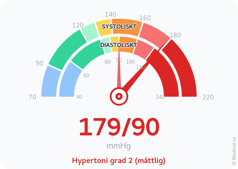 Blodtryck 179 över 90 – hypertoni grad 2 (måttlig) – visuell mätare