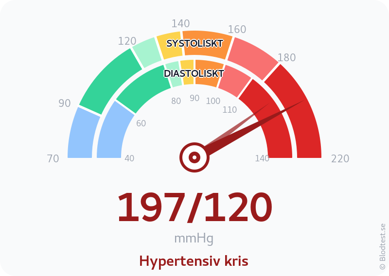 Blodtryck 197 över 120 – hypertensiv kris – visuell mätare
