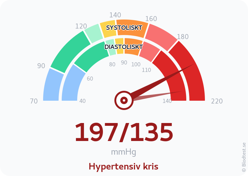 Blodtryck 197 över 135 – hypertensiv kris – visuell mätare