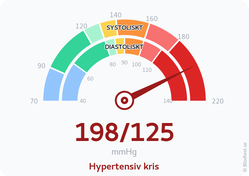 Blodtryck 198 över 125 – hypertensiv kris – visuell mätare