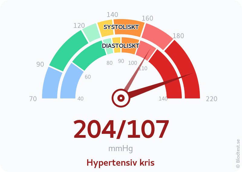 Blodtryck 204 över 107 – hypertensiv kris – visuell mätare
