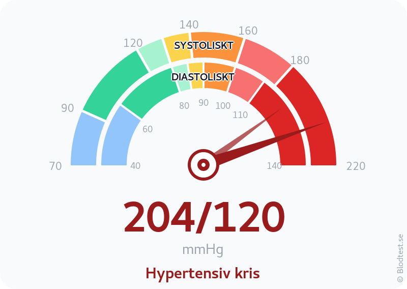 Blodtryck 204 över 120 – hypertensiv kris – visuell mätare