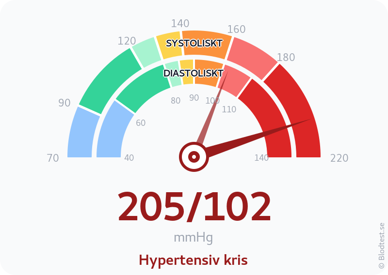 Blodtryck 205 över 102 – hypertensiv kris – visuell mätare