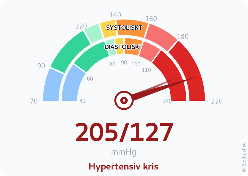 Blodtryck 205 över 127 – hypertensiv kris – visuell mätare