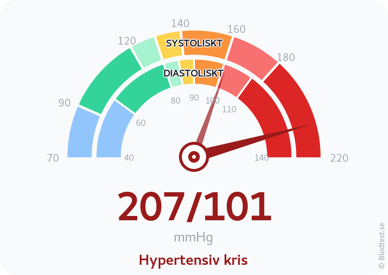 Blodtryck 207 över 101 – hypertensiv kris – visuell mätare