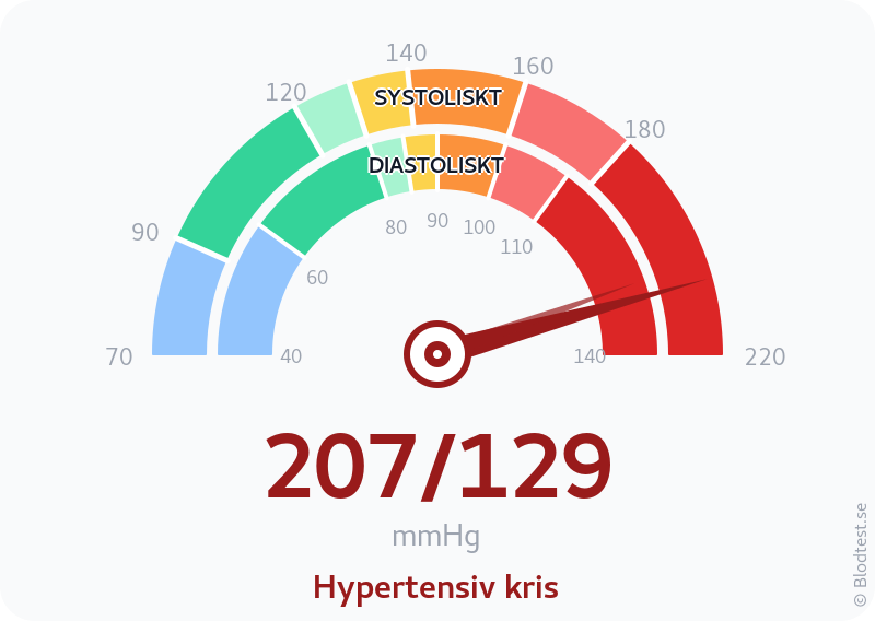 Blodtryck 207 över 129 – hypertensiv kris – visuell mätare