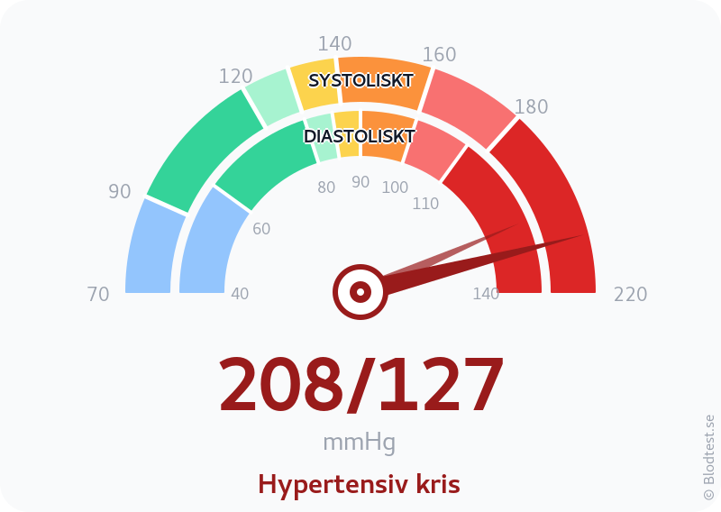 Blodtryck 208 över 127 – hypertensiv kris – visuell mätare