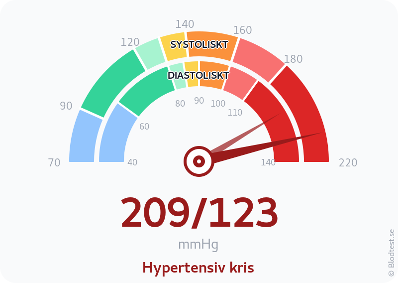 Blodtryck 209 över 123 – hypertensiv kris – visuell mätare