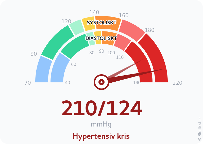 Blodtryck 210 över 124 – hypertensiv kris – visuell mätare