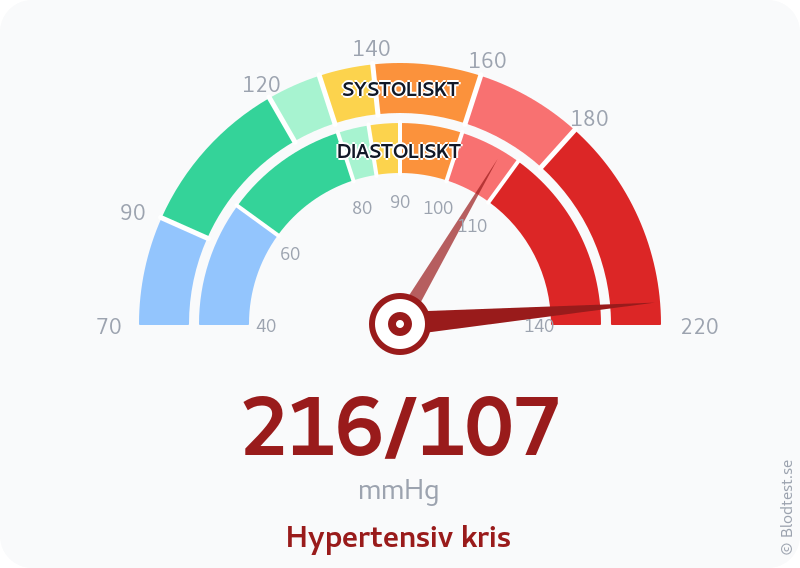 Blodtryck 216 över 107 – hypertensiv kris – visuell mätare