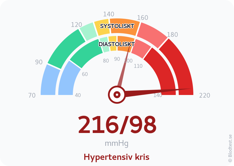 Blodtryck 216 över 98 – hypertensiv kris – visuell mätare