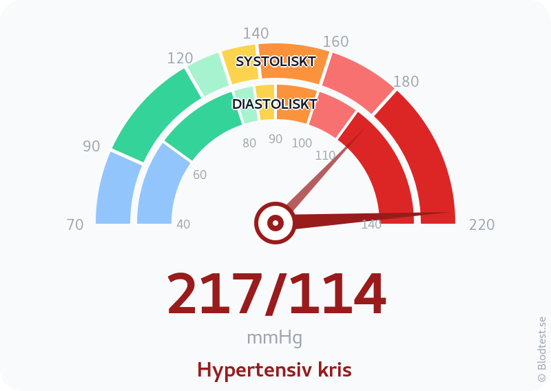 Blodtryck 217 över 114 – hypertensiv kris – visuell mätare