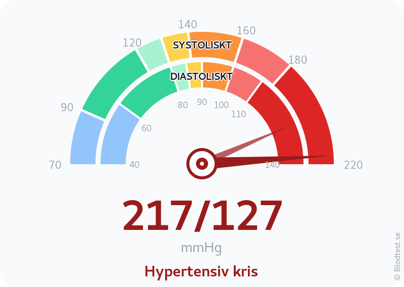 Blodtryck 217 över 127 – hypertensiv kris – visuell mätare