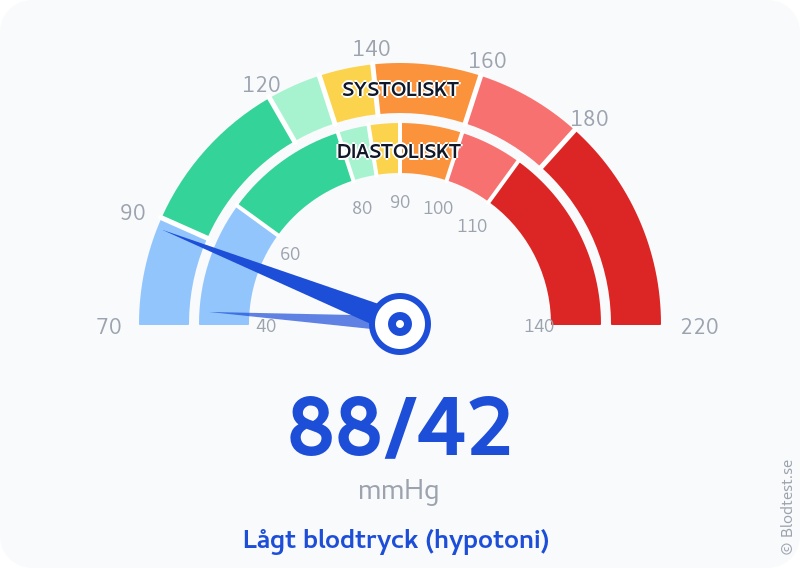 Blodtryck 88 över 42 – lågt blodtryck (hypotoni) – visuell mätare