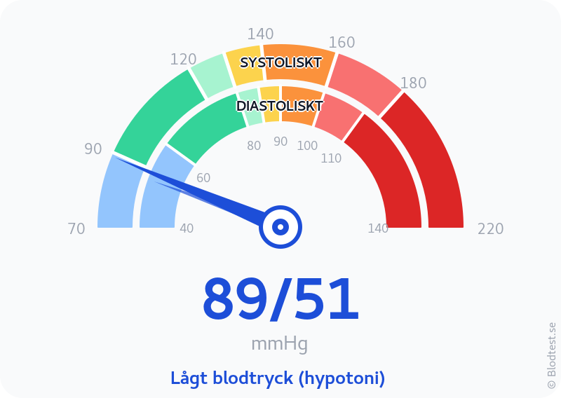 Blodtryck 89 över 51 – lågt blodtryck (hypotoni) – visuell mätare