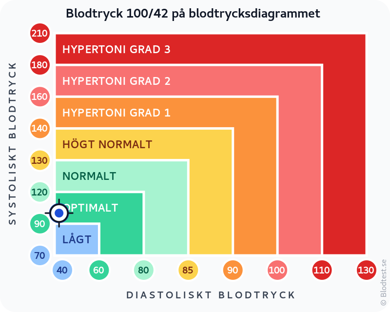 Blodtryck 100 över 42 – lågt blodtryck (hypotoni) – klassificeringsdiagram med systoliskt och diastoliskt värde