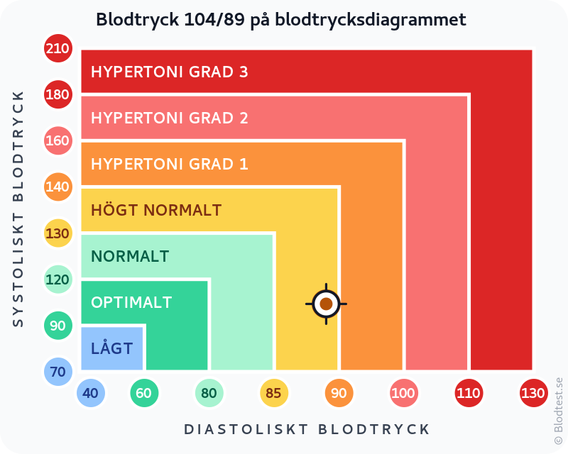 Blodtryck 104 över 89 – högt normalt blodtryck – klassificeringsdiagram med systoliskt och diastoliskt värde
