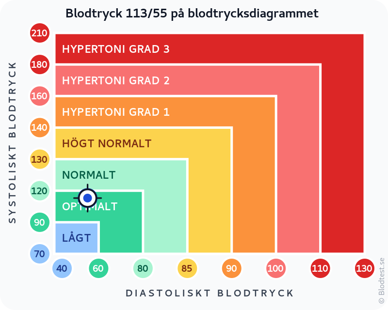 Blodtryck 113 över 55 – lågt blodtryck (hypotoni) – klassificeringsdiagram med systoliskt och diastoliskt värde