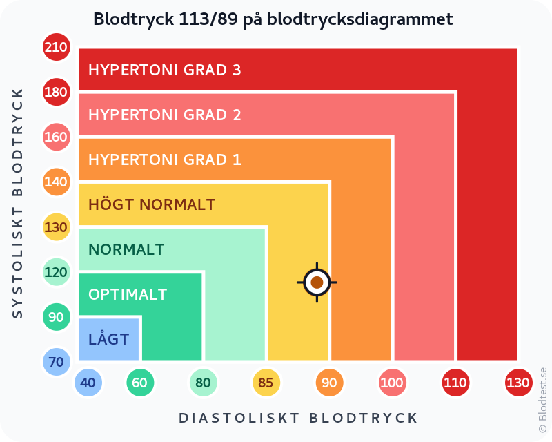 Blodtryck 113 över 89 – högt normalt blodtryck – klassificeringsdiagram med systoliskt och diastoliskt värde