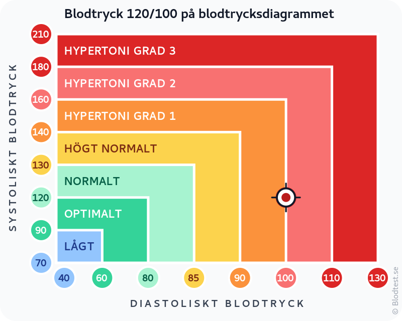 Blodtryck 120 över 100 – hypertoni grad 2 (måttlig) – klassificeringsdiagram med systoliskt och diastoliskt värde