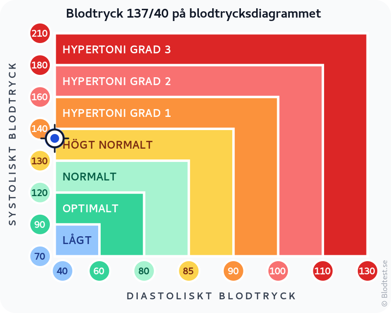 Blodtryck 137 över 40 – lågt blodtryck (hypotoni) – klassificeringsdiagram med systoliskt och diastoliskt värde