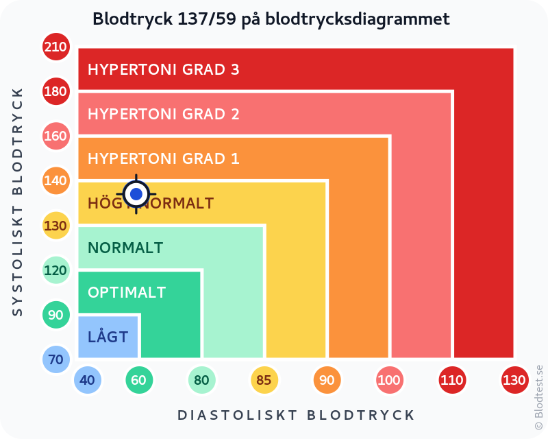 Blodtryck 137 över 59 – lågt blodtryck (hypotoni) – klassificeringsdiagram med systoliskt och diastoliskt värde