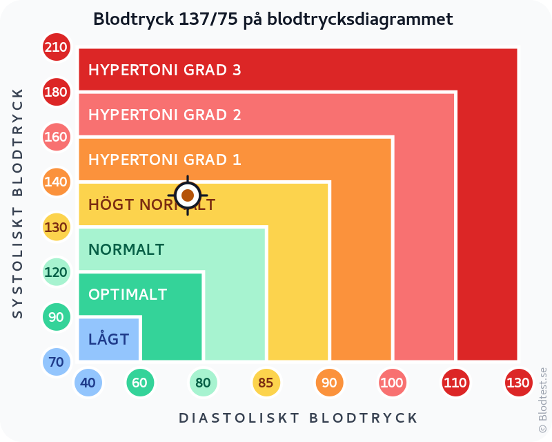 Blodtryck 137 över 75 – högt normalt blodtryck – klassificeringsdiagram med systoliskt och diastoliskt värde