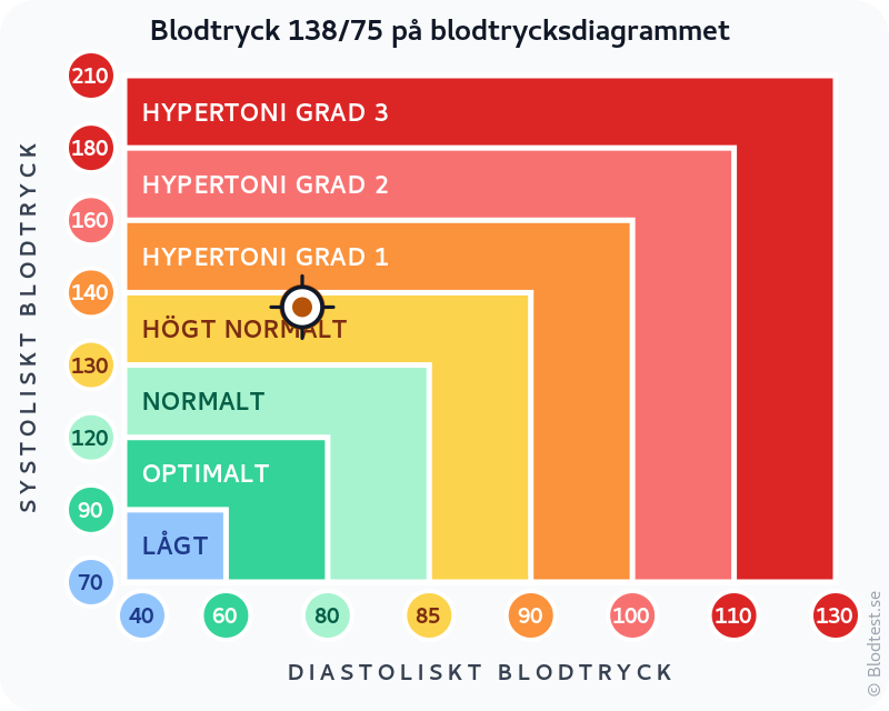 Blodtryck 138 över 75 – högt normalt blodtryck – klassificeringsdiagram med systoliskt och diastoliskt värde