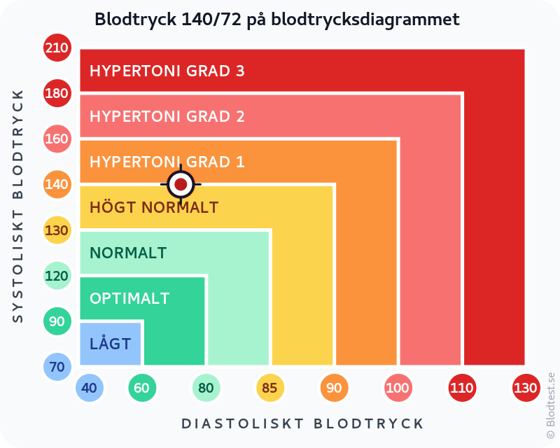 Blodtryck 140 över 72 – isolerad systolisk hypertoni – klassificeringsdiagram med systoliskt och diastoliskt värde