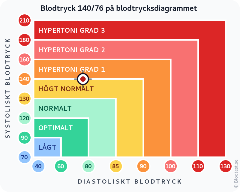 Blodtryck 140 över 76 – isolerad systolisk hypertoni – klassificeringsdiagram med systoliskt och diastoliskt värde