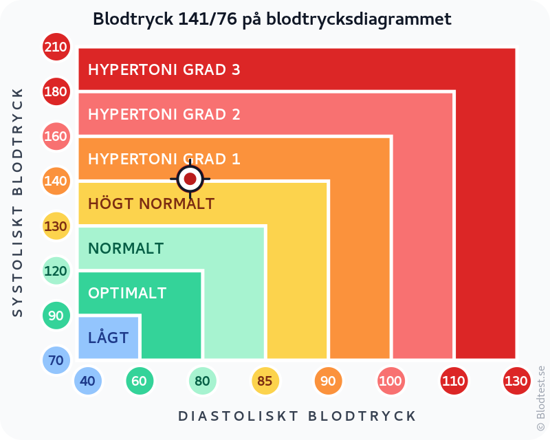 Blodtryck 141 över 76 – isolerad systolisk hypertoni – klassificeringsdiagram med systoliskt och diastoliskt värde